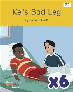 Kel's Bad Leg